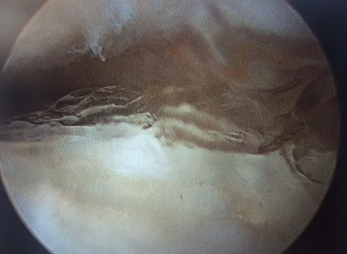 Weston Davis Equine Surgery 12