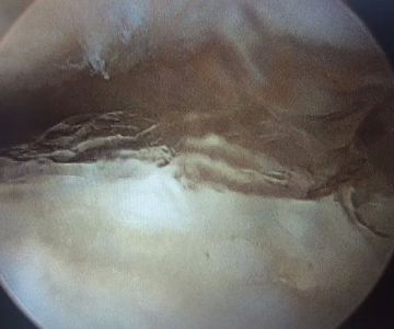 Weston Davis Equine Surgery