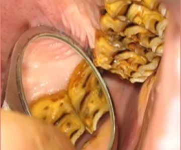 Northeast Equine Veterinary Dental Services, LLC